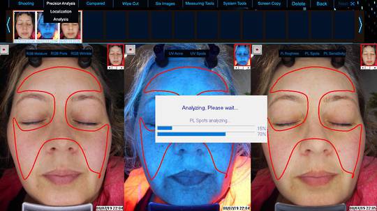 DermaPro6S Photographic full face skin scanner and detailed analyser image 3